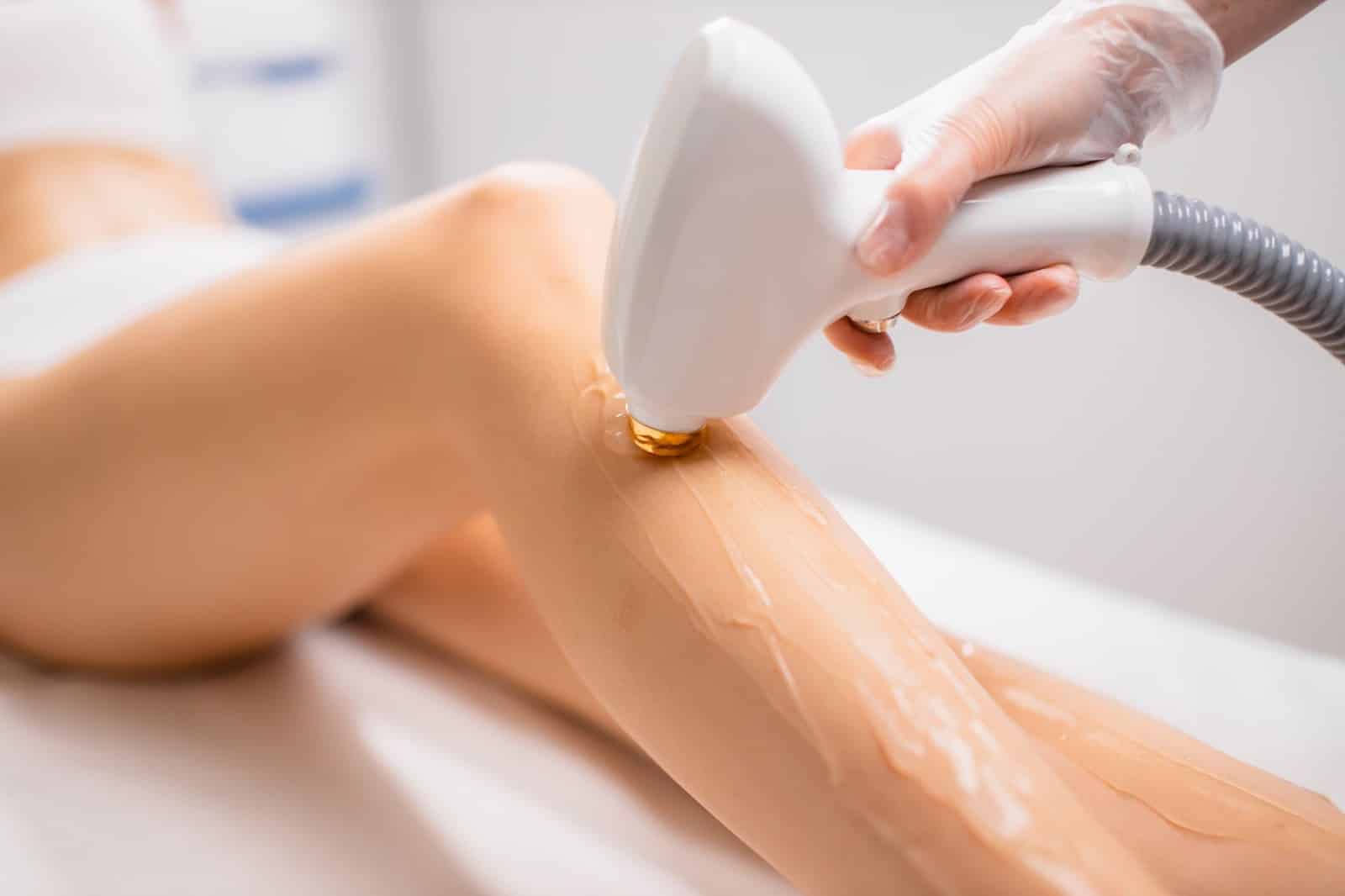 A close-up of a laser hair removal device being used on a person's leg with gel applied.