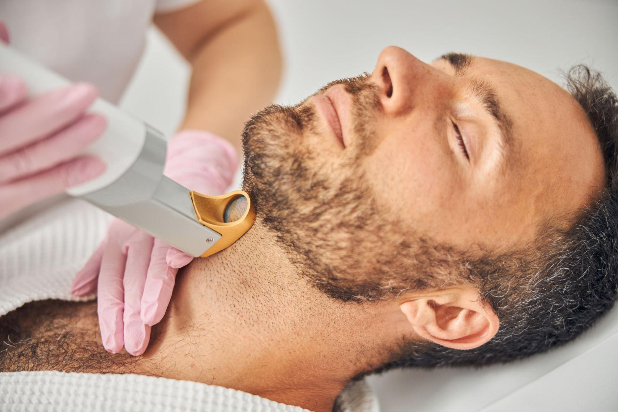 Male patient receiving laser hair removal treatment on the beard and neck area to reduce unwanted facial hair and achieve long-term hair reduction.